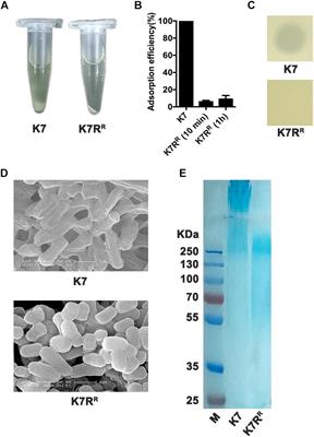 Three Capsular Polysaccharide Synthesis-Related Glucosyltransferases, GT-1, GT-2 and WcaJ, Are Associated With Virulence and Phage Sensitivity of Klebsiella pneumoniae